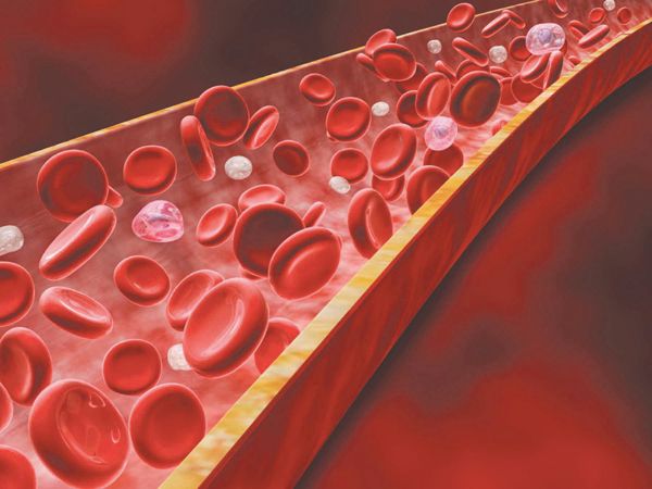 [Cảnh báo] Top 6 căn bệnh tim mạch thường gặp trong xã hội hiện đại