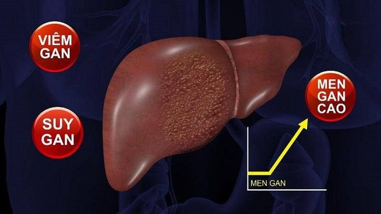 Men gan cao có nguy hiểm không?