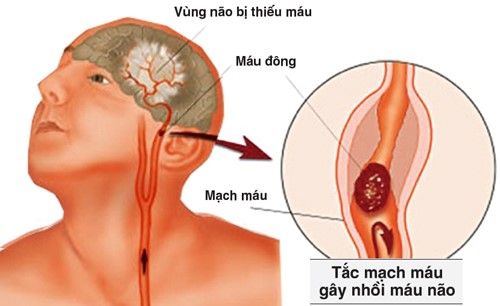 eDoctor