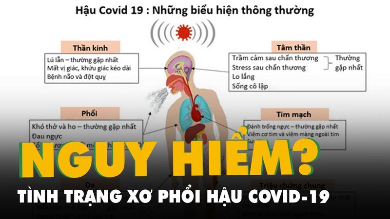 Ai dễ mắc xơ phổi hậu COVID, di chứng này có nguy hiểm không?