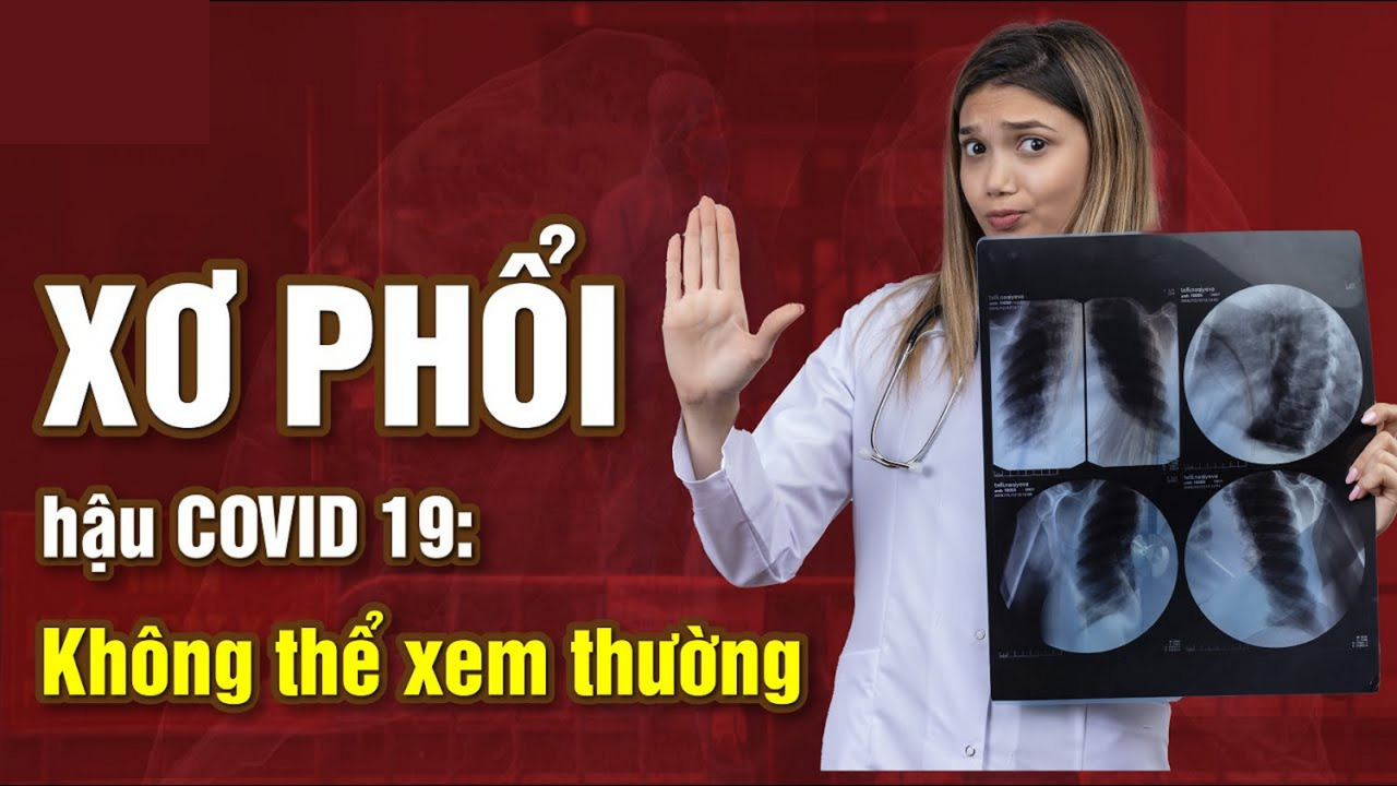 Ai dễ mắc xơ phổi hậu COVID, di chứng này có nguy hiểm không?