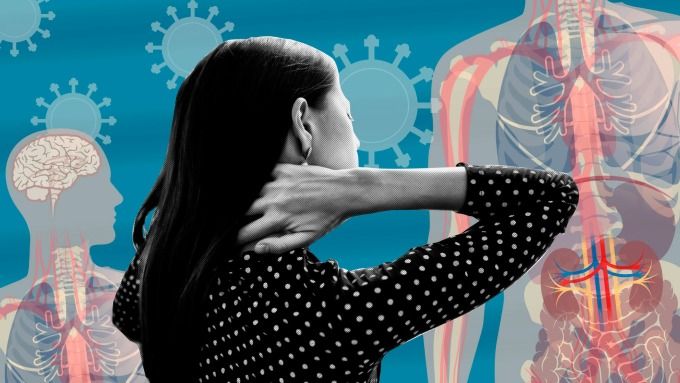 Nhiều F0 chưa hồi phục hoàn toàn sau một năm