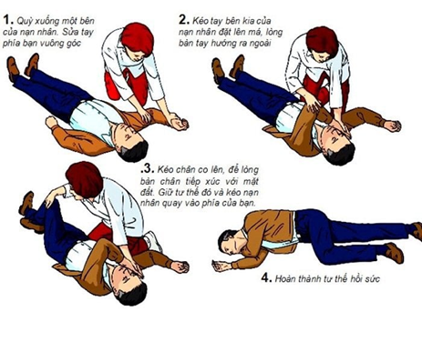 Đột quỵ ở trẻ: Nguyên nhân, dấu hiệu và các biện pháp phòng ngừa