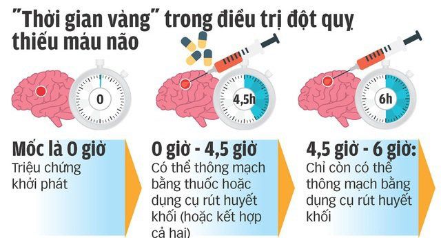 “Giờ vàng” giúp bệnh nhân đột quỵ thoát hiểm