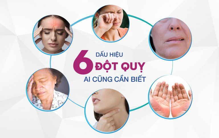 “Giờ vàng” giúp bệnh nhân đột quỵ thoát hiểm