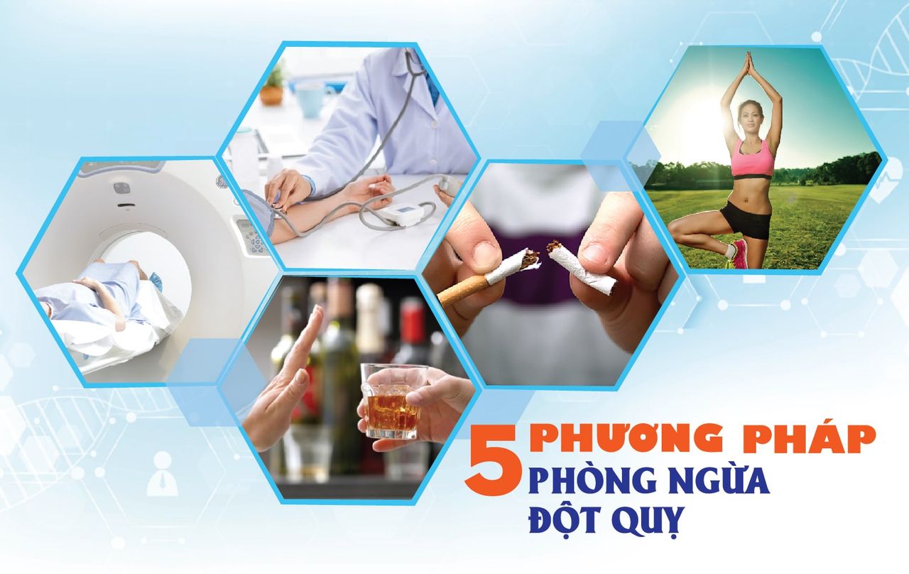 5 phương pháp phòng ngừa đột quỵ hữu hiệu