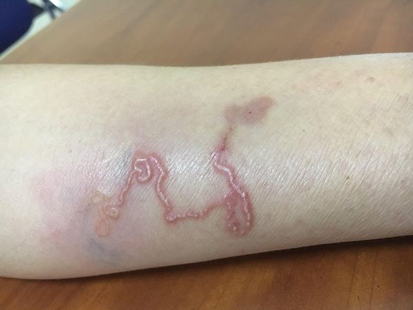 Một số bệnh ký sinh trùng có thể mắc phải khi nuôi thú cưng