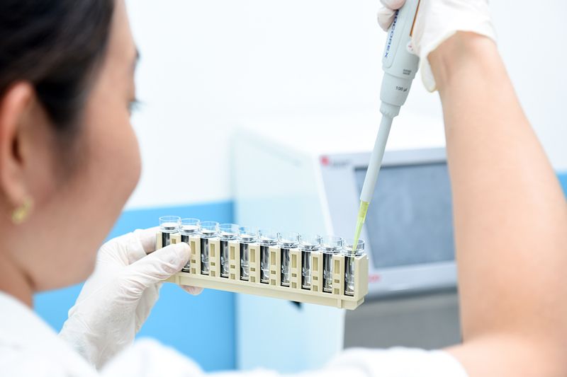 Khi nào cần thực hiện xét nghiệm ký sinh trùng?