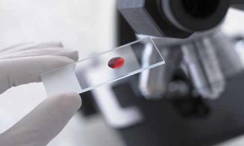 Khi nào cần thực hiện xét nghiệm ký sinh trùng?