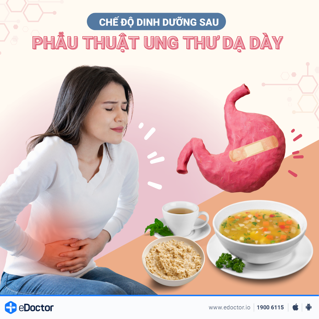 Chế độ dinh dưỡng sau phẫu thuật ung thư dạ dày