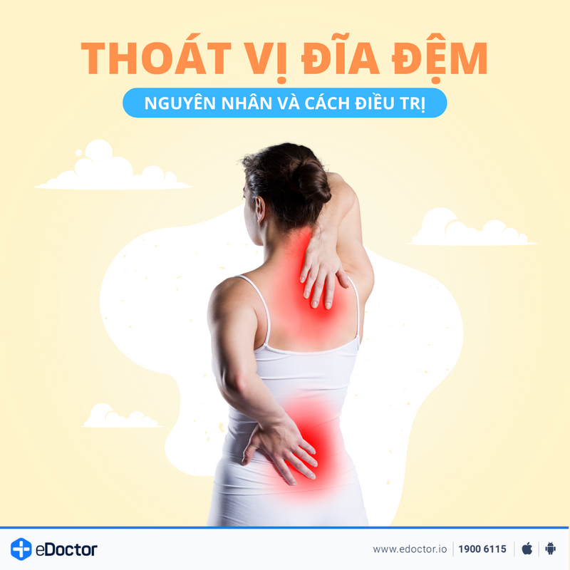 Nguyên nhân và cách điều trị thoát vị đĩa đệm