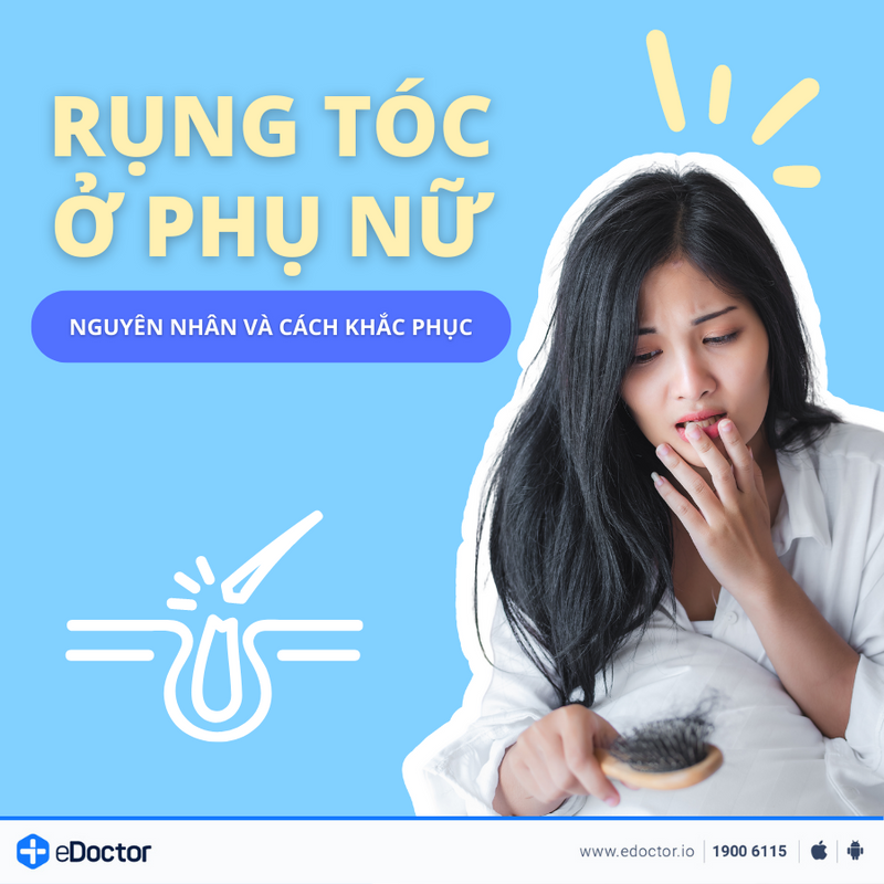 Rụng tóc ở phụ nữ