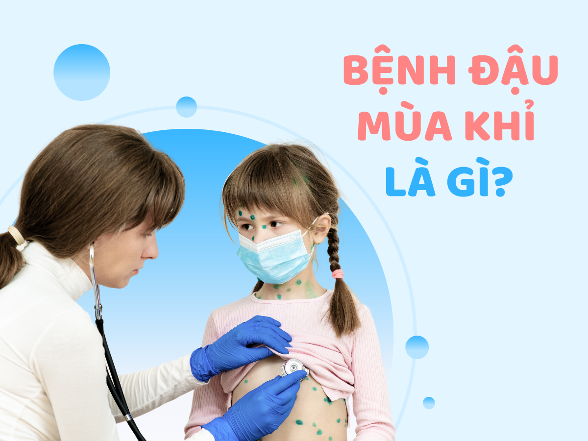 Bệnh đậu mùa khỉ: Triệu chứng và cách phòng bệnh
