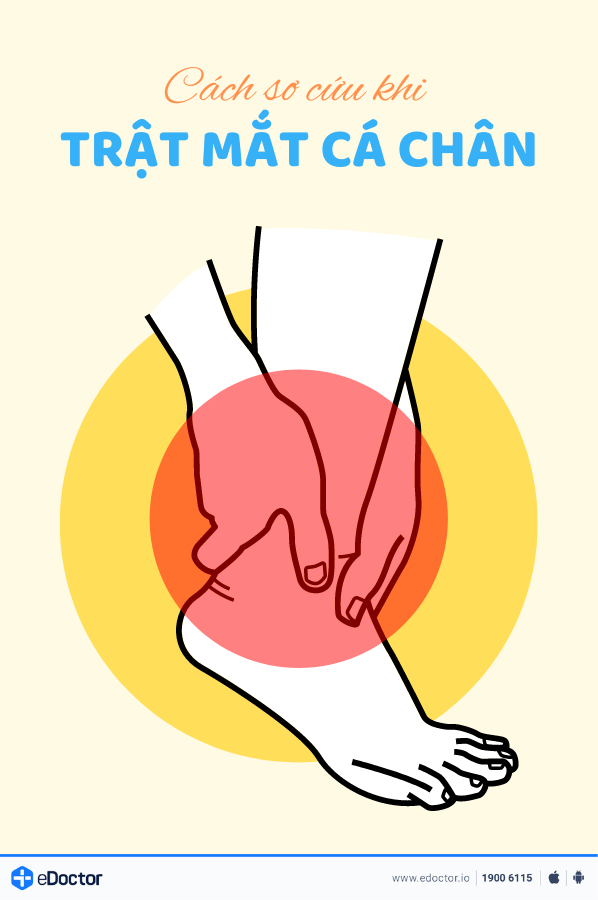 Cách sơ cứu khi trật mắt cá chân