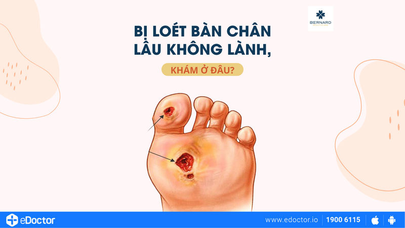 Bị loét bàn chân lâu không lành, khám ở đâu?