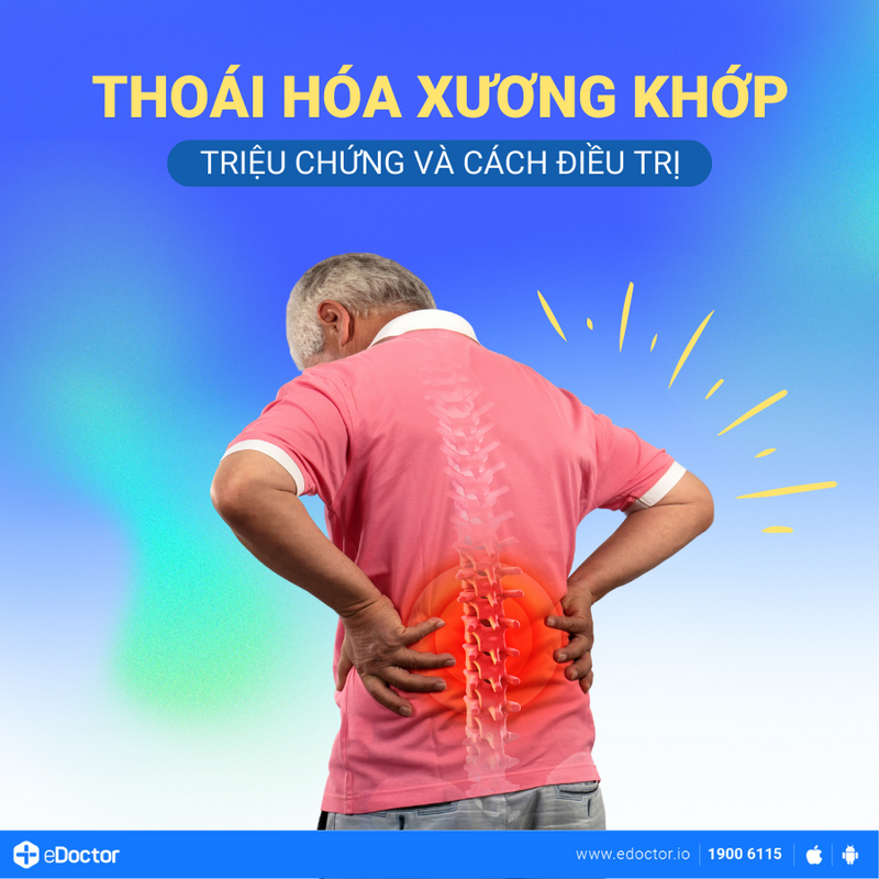 Thoái hóa xương khớp: Triệu chứng và cách điều trị