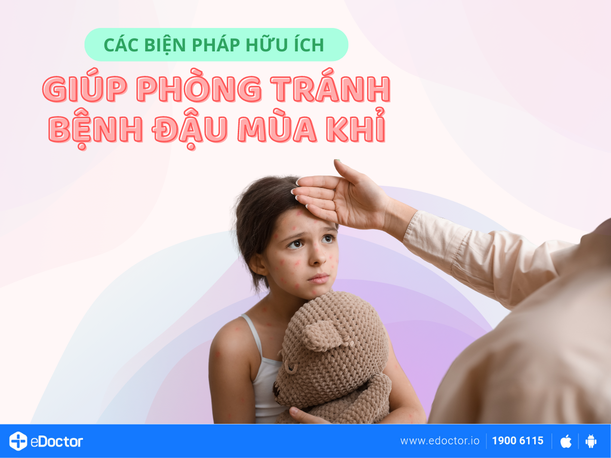 Các biện pháp hữu ích giúp phòng tránh bệnh Đậu mùa khỉ
