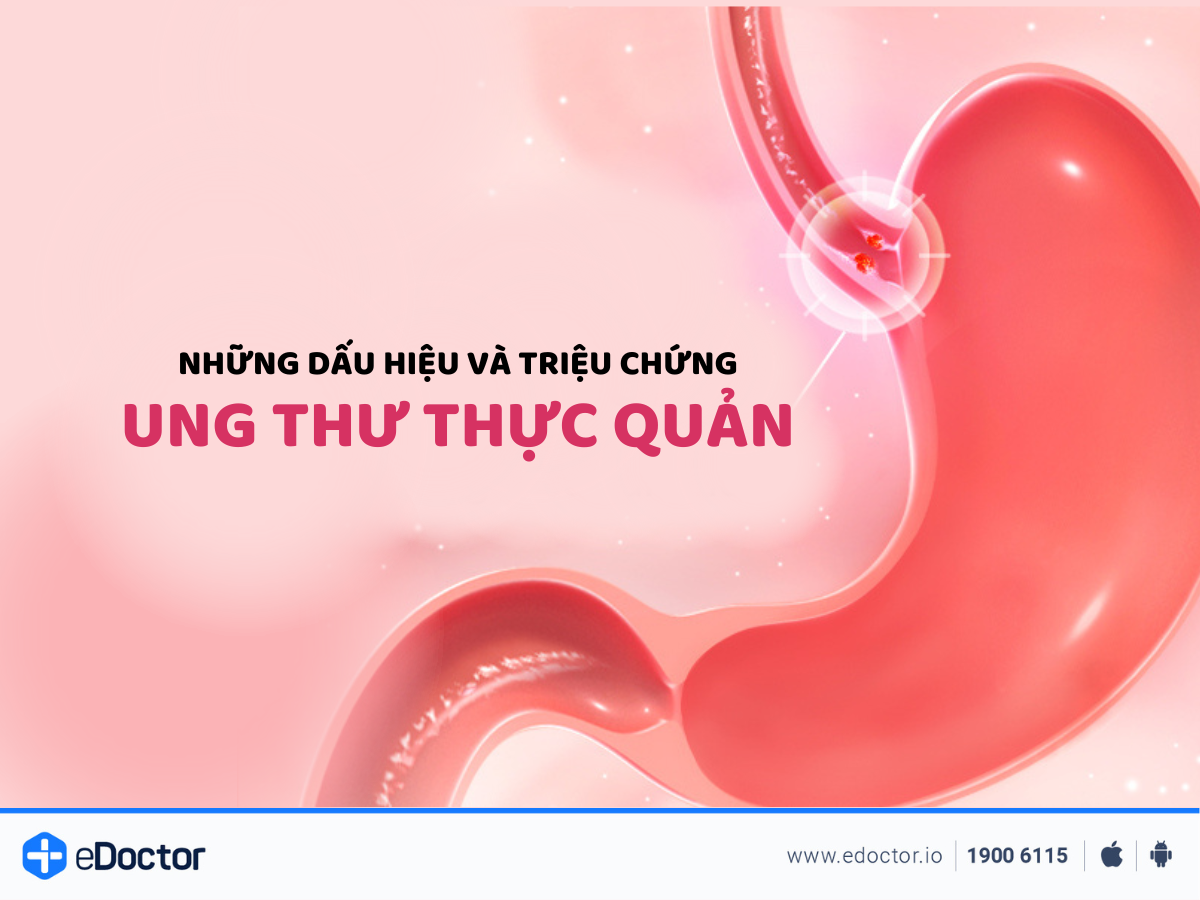 Những dấu hiệu và triệu chứng ung thư thực quản