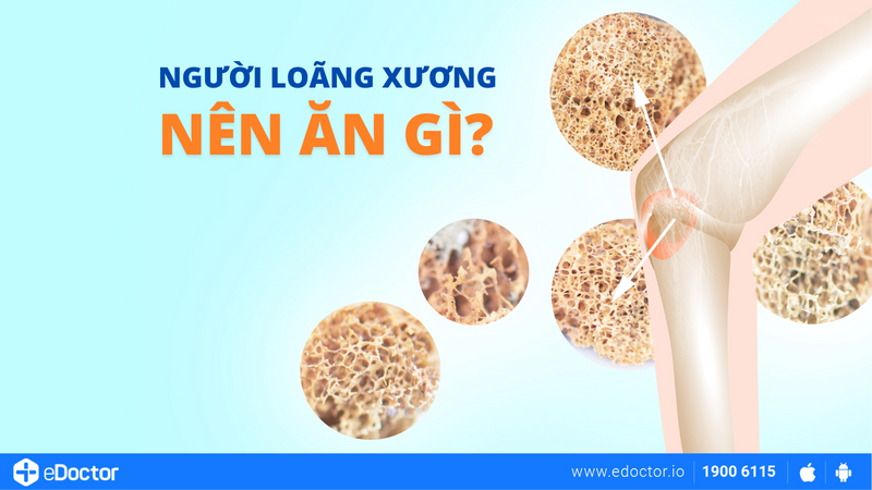 Người loãng xương nên ăn gì?